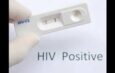 Adamawa State records 8,850 new HIV cases in four years