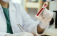 Scientists develop new blood test capable of detecting over 50 types of cancer early