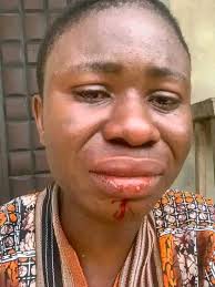 Woman who accused Rivers LGA chairman of ass@ult after exposing dilapidated school rejects N2.5m paid into her account as compensation