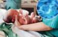 Doctors warn of concerning trait in newborns that may impact future health