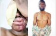 Suspect says he was paid N500,000 to attack spa worker with acid, claims she was the wrong target