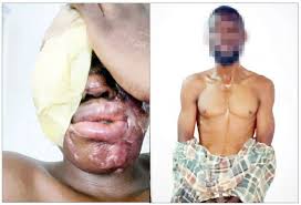 Suspect says he was paid N500,000 to attack spa worker with acid, claims she was the wrong target