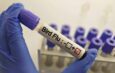 Australia Detects First Case of Contagious H5 Bird Flu