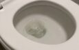 Foamy Urine: What You Should Know and When to Get Checked