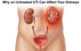 Why an Untreated UTI Can Affect Your Kidneys